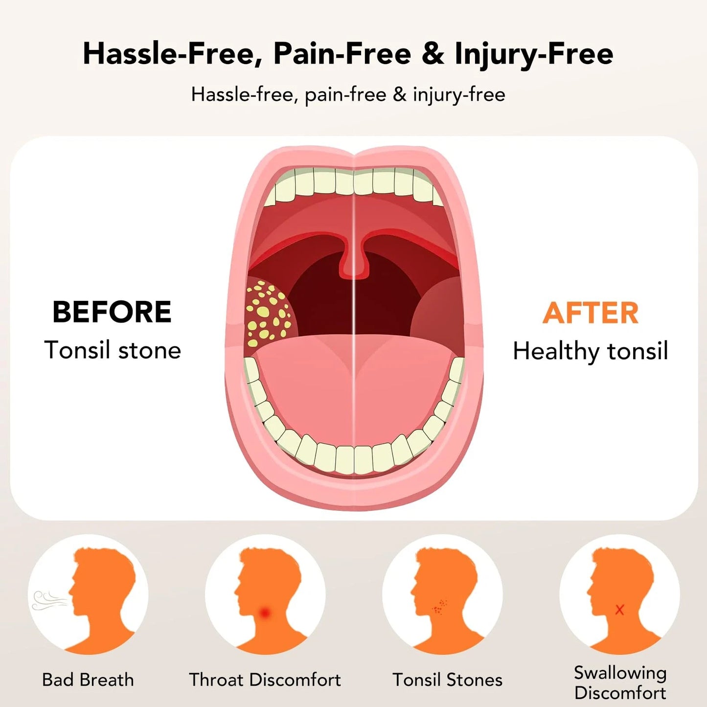 Sonease Tonsil Stones Cleaner