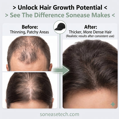 Sonease Anti Hair Loss Hat