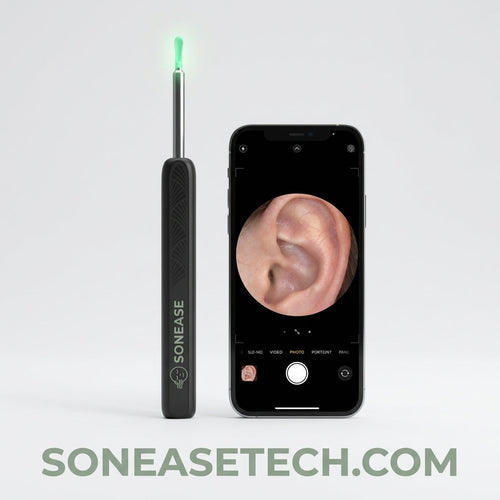 Sonease™ ear camera device